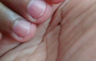 “Mi hijo se muerde las uñas”: 10 consejos para quitarle el hábito