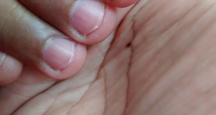 Respecto a Extra exégesis Mi hijo se muerde las uñas": 10 consejos para quitarle el hábito