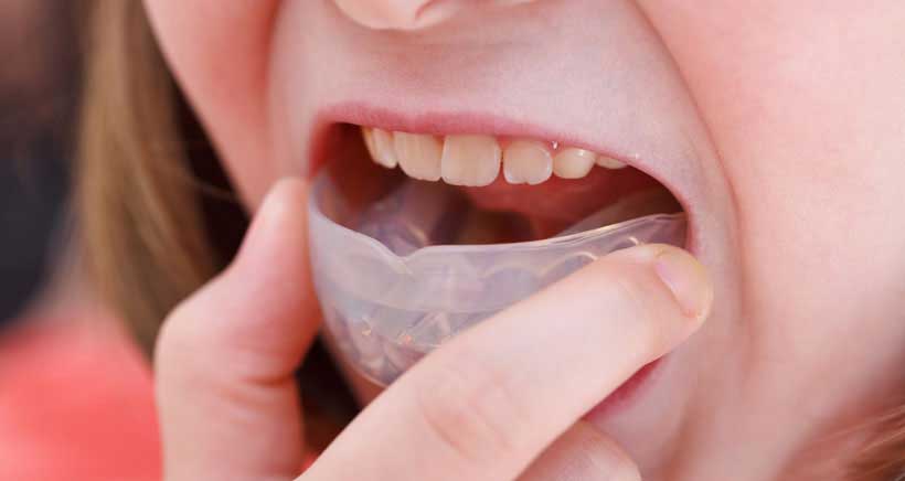 ¿Cuál es la edad para poner una ortodoncia?